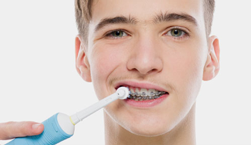 Using electric toothbrush to brush teeth with braces.